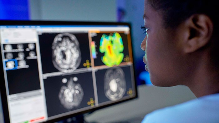 Smart Workflows: Improving imaging productivity and clinical confidence with AI