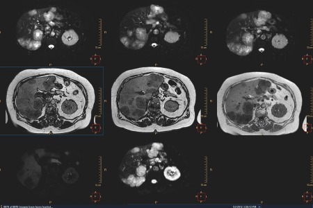 clinical area oncology