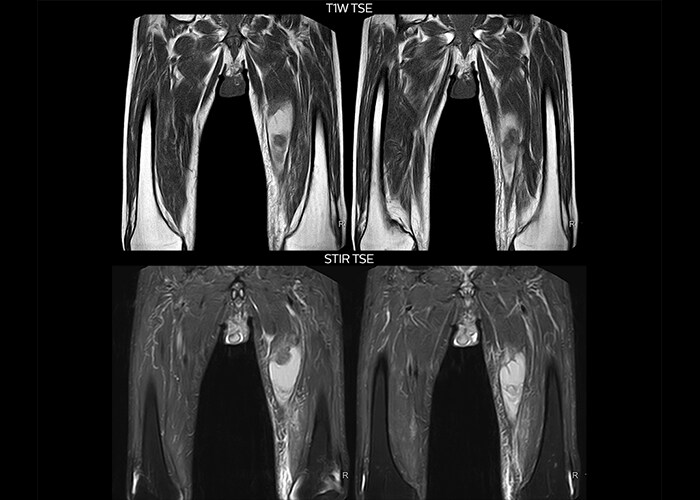 clinical cases tab1 image