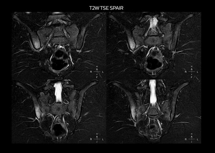 clinical cases tab2 image2