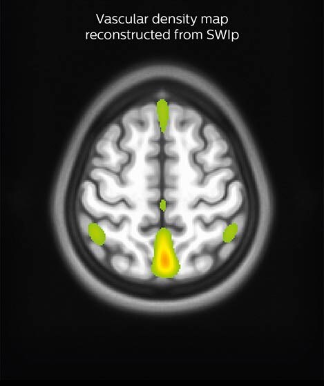 Sherbrooke_SWIp