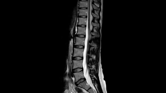 Spine image