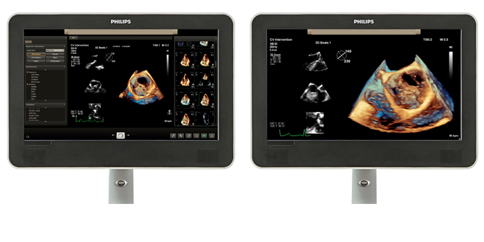 Viewing area comparison with a cardiology ultrasound image on screen.