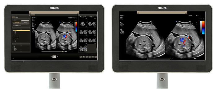 Viewing area comparison with an obstetrics image on screen.