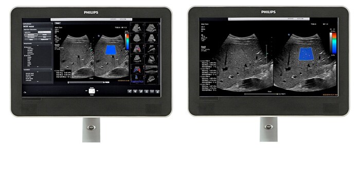 Viewing area comparison with an ElastQ ultrasound image on screen