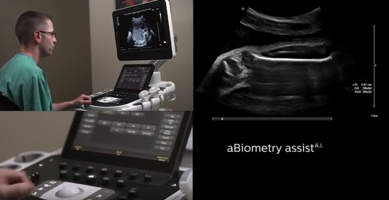 Philips biometry assist