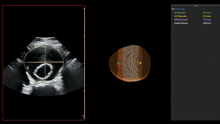 Medical ultrasound image
