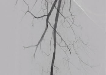 a clinical image of veins