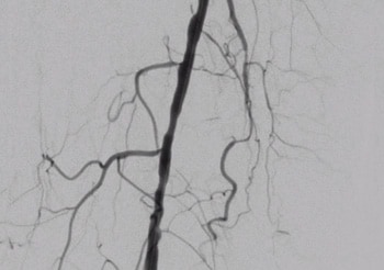a clinical image of veins