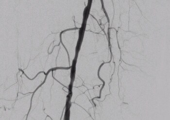 a clinical image of veins