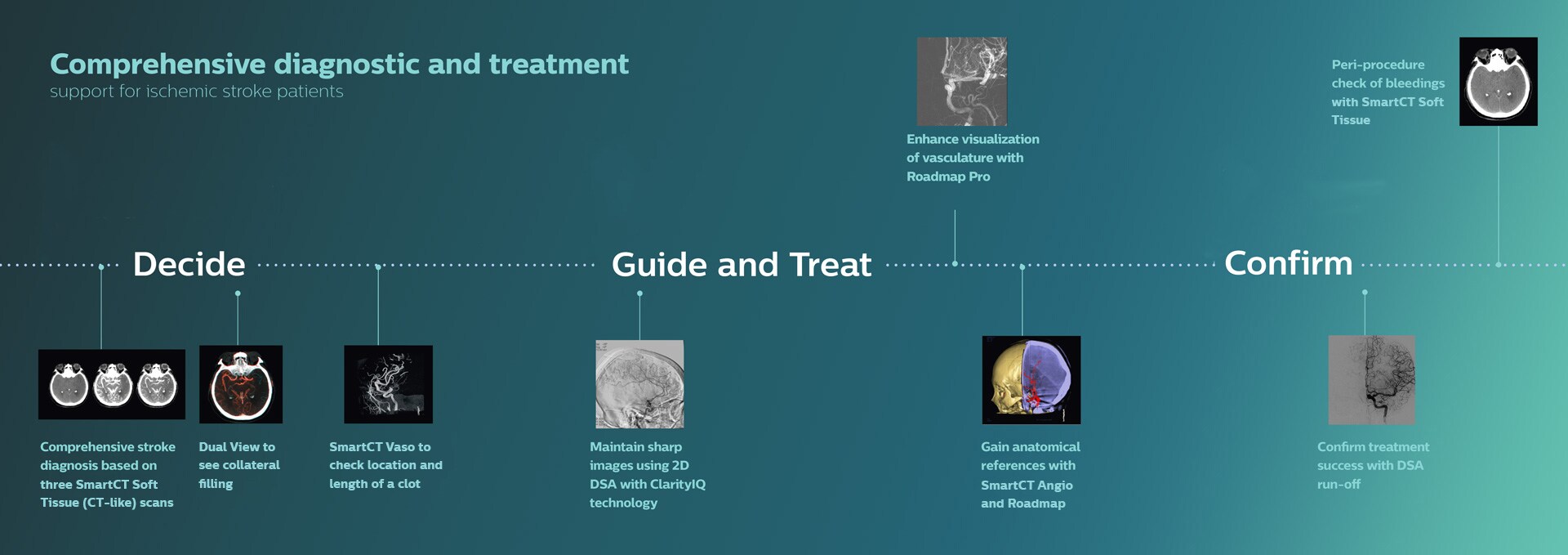 Clinical ischemic stroke solutions download image