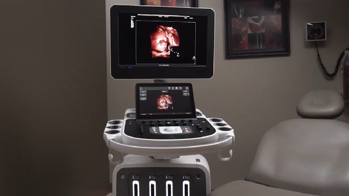 Dr. Michael Ruma discusses Philips ultrasound features: TrueVue Pro, TouchVue, MPR Touch, Touch Sculpt, Touch Erase, Touch Zoom and aReveal 