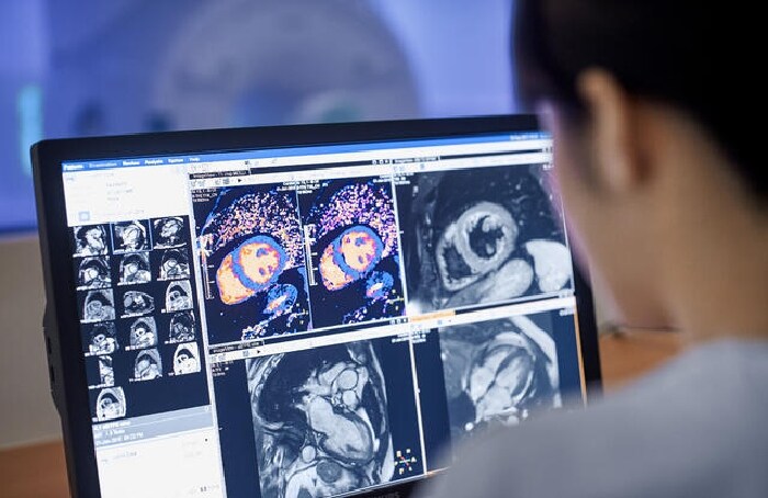 Computer, tablet and phone with MR body map page that shows clinical cases from nearly every anatomy