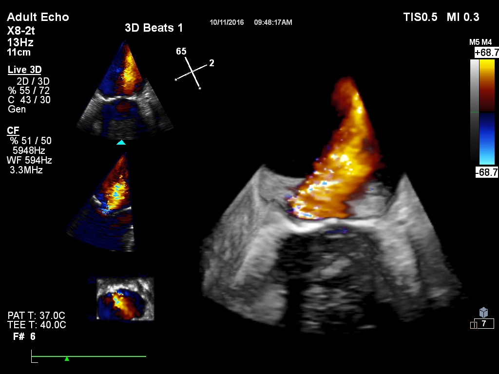  adult-echo-clinical-image