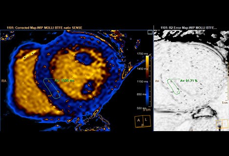 quantative mapping