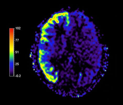 3d asl tab 4 image