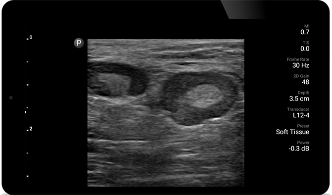 Ultrasound exam