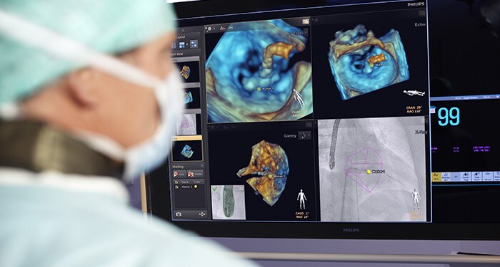 Tutor - Transform the learning and education experience with digital pathology | Philips