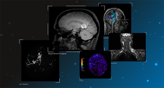 Elevate Neuro diagnostics