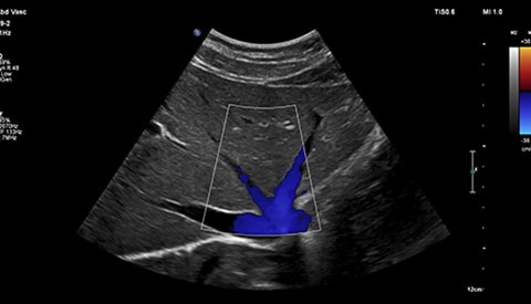 ultrasound maxvue