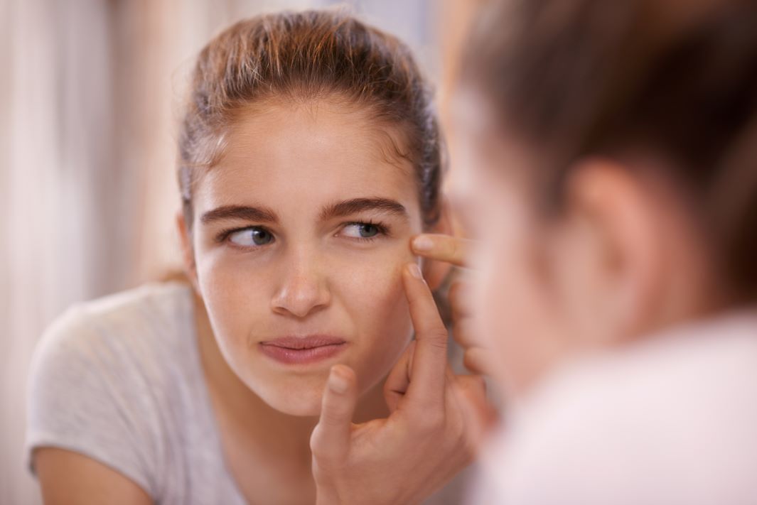 Do not eat or drink with acne