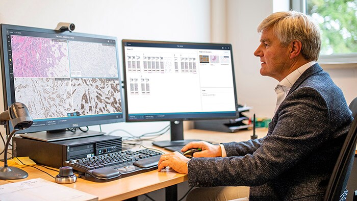 Philips boosts digital pathology with enhanced informatics to advance precision diagnosis in oncology